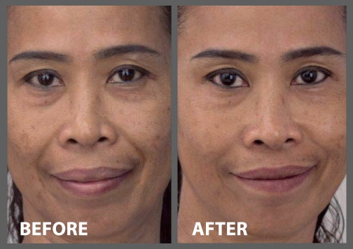 2 Minute Miracle Peptide+ Serum