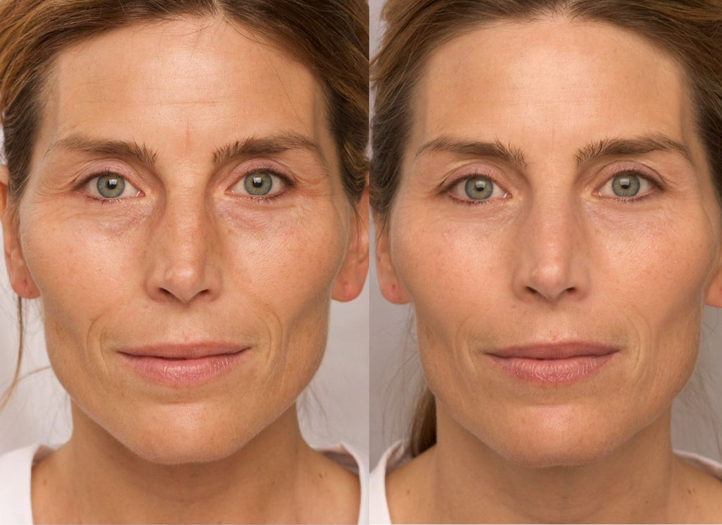 2 Minute Miracle Eye Serum